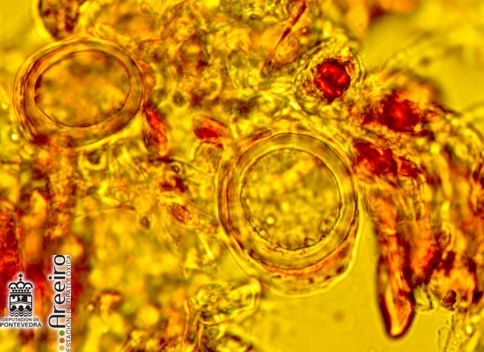 Oosporas (huevos de invierno) vistos al microscopio